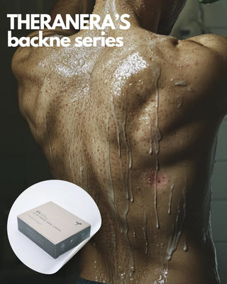 For Body Acne Which Soap Is Best in Denmark? A Scientific Guide Theranera