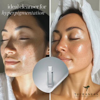 When Does Kojic Acid Soap Work Theranera