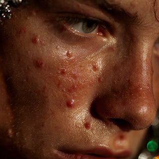 Gut-Microbiome-and-Skin-Health-Strengthening-the-Barrier-from-Within Theranera